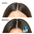Shampoo Scalp Advanced Dermo Regulator Anti-Discomfort L´Oréal Professionnel