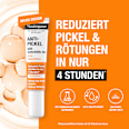 Anti Pickel Gel SOS Soforthilfe  Neutrogena