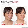 Revitalift Laser X3 Triple Action Anti-Aging dnevna krema za lice L'ORÉAL PARiS REVITALIFT