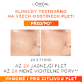 pleťové sérum Revitalift Clinical s vitamínem C L'ORÉAL PARiS REVITALIFT