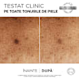 Serum anti pete pigmentare  L'ORÉAL PARiS