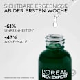 Anti-Unreinheiten Serum Derma Control L'ORÉAL PARiS MEN EXPERT