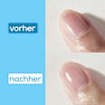 Nagelhärter Hard to resist advanced essie