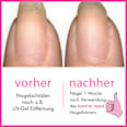 Nagelhärter Hard To Resist Nail Strengthener essie