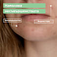 Почистващ гел за лице против несъвършенства Anti-Imperfection Comfort Mixa