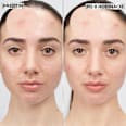 hydrokoloidní náplast na akné Invisible GARNIER PureActive
