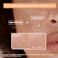 Serum Anti-Pigmentflecken Mixa
