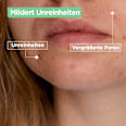 Gel-Creme mattierend Anti-Unreinheiten Mixa