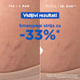 Ulje protiv strija Mixa