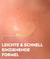 Serum Cellular Luminous 630 Anti Pigmentflecken + Pickelmale NIVEA