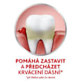 zubní pasta Fluoride 2x75 ml parodontax