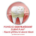 zubní pasta Fluoride 2x75 ml parodontax