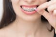 Ortho Wachs für Zahnspangen GUM