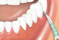 Interdentalpicks soft S GUM
