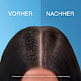 Shampoo Tiefenfeuchtigkeit head&shoulders