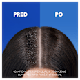 Šampón proti lupinám Anti-Hair Fall Caffeine head&shoulders