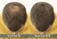 Streuhaar – Nr. 3 - 4 Dark Brown Cover Hair