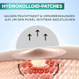 Anti Pickel Pimple Patches Hydrokolloid  Garnier Skin Active