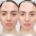 Anti Pickel Pimple Patches Hydrokolloid  Garnier Skin Active