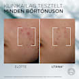Szérum bőrhibák ellen, Derma Control L'ORÉAL PARiS MEN EXPERT