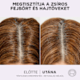 Balzsam Hyaluron Pure L'ORÉAL PARiS ELSEVE