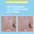 Denný pleťový UV fluid proti nedokonalostiam BHA + Niacinamide SPF 50+ GARNIER PureActive