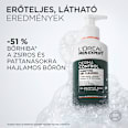 Arctisztító gél, Derma Control L'ORÉAL PARiS MEN EXPERT