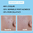 Cremă fluidă invizibilă anti-imperfecțiuni cu SPF 50+ GARNIER PureActive