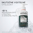 Čistiaci pleťový gél na akné Derma Control L'ORÉAL PARiS MEN EXPERT