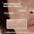 Serum anti pete pigmentare pentru tenul sensibil Mixa
