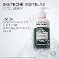 Derma Control čisticí pleťový gel  L'ORÉAL PARiS MEN EXPERT