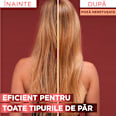 Ser pentru păr fragil cu tendință de cădere, Full Resist Aminexil L'ORÉAL PARiS ELSEVE