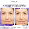 Revitalift filler szérum, hyaluronnal L'ORÉAL PARiS REVITALIFT