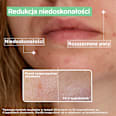 Serum przeciw niedoskonałościom Mixa