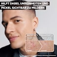 Serum Anti-Unreinheiten AHA + BHA Kohle Garnier Skin Active