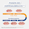 Pencivir bei Lippenherpes 10 mg/g Creme PENCIViR