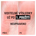 Krém na veľmi suchú pokožku chodidiel Neutrogena