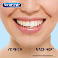 Bleaching Strips  Rapid white