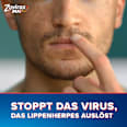Zovirax Duo Creme bei Lippenherpes. 5 % Aciclovir, 1 % Hydrocortison Tube Zovirax