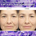Revitalift filler szérum, hyaluronnal L'ORÉAL PARiS REVITALIFT