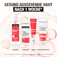 Anti Pickel Gesichtsgel Niacinamide+Panthenol Neutrogena