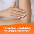 Hydrocortison-ratiopharm 0,5% Creme ratiopharm
