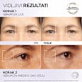 REVITALIFT FILLER anti-age serum za područje oko očiju - hijaluronska kiselina i kofein L'ORÉAL PARiS