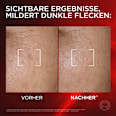 Anti Age Gesichtsserum Revitalift Laser Dreifach Laser L'ORÉAL PARiS