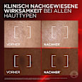 Anti Age Gesichtsserum Revitalift Laser Dreifach Laser L'ORÉAL PARiS