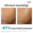 Eucerin Dermopure Clinical Hydra Repair Feuchtgkeitspflege Eucerin