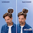 Shampoo Anti-Schuppen XTRA schauma