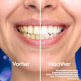 Zahnpasta Pro 3D White Clinical Intensive Whitening Oral-B