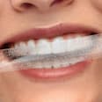 Night Whitening Strips smilepen