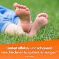 Fungizid-ratiopharm Clotrimazol Pumpspray zur Anwendung auf der Haut ratiopharm